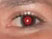 Removing Red Eye With Photoshop CS2