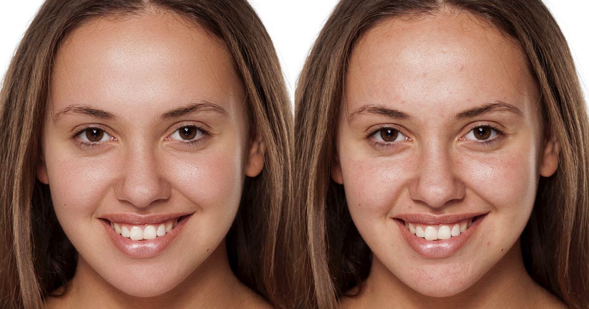 Easily Smooth And Soften Skin In A Photo With Photoshop